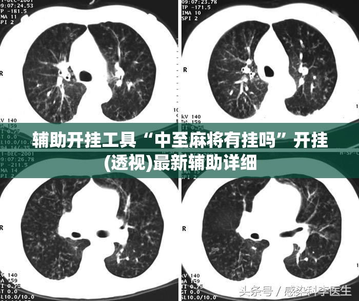 辅助开挂工具“中至麻将有挂吗”开挂(透视)最新辅助详细