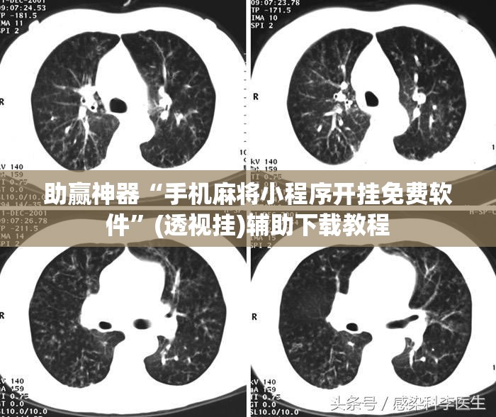 助赢神器“手机麻将小程序开挂免费软件”(透视挂)辅助下载教程