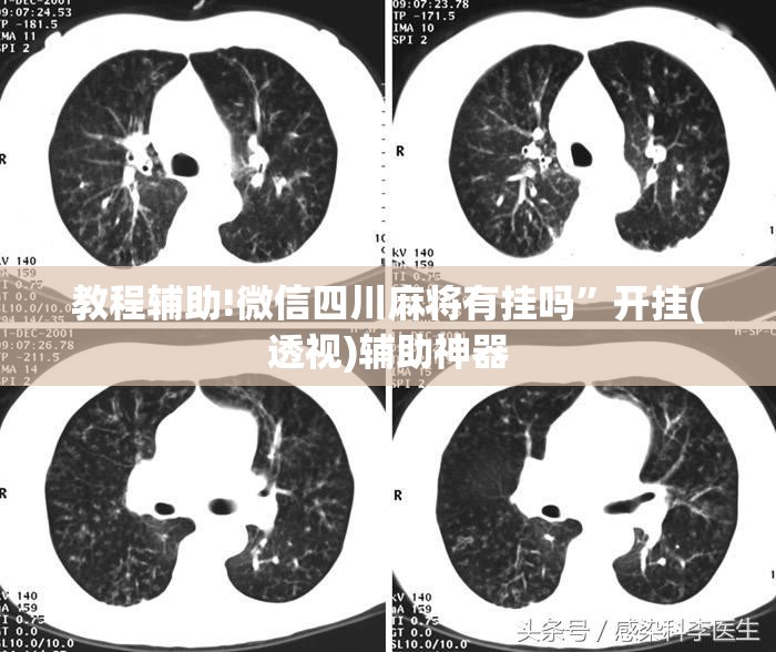 教程辅助!微信四川麻将有挂吗”开挂(透视)辅助神器