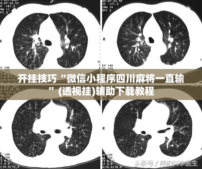 开挂技巧“微信小程序四川麻将一直输”(透视挂)辅助下载教程