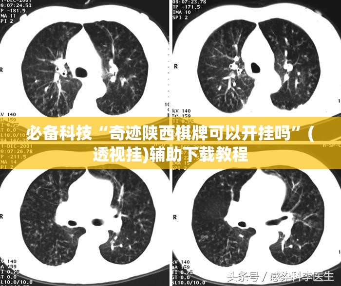 必备科技“奇迹陕西棋牌可以开挂吗”(透视挂)辅助下载教程