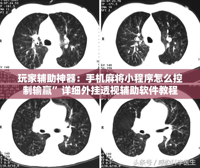 玩家辅助神器：手机麻将小程序怎么控制输赢	”详细外挂透视辅助软件教程