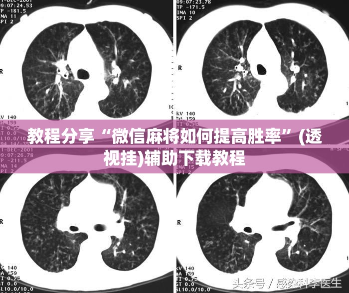 教程分享“微信麻将如何提高胜率	”(透视挂)辅助下载教程