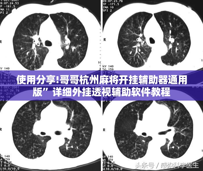 使用分享!哥哥杭州麻将开挂辅助器通用版”详细外挂透视辅助软件教程