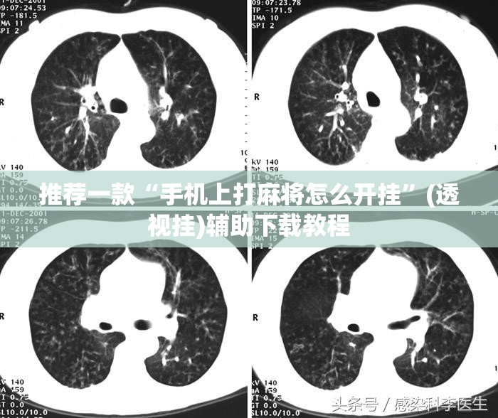 推荐一款“手机上打麻将怎么开挂”(透视挂)辅助下载教程