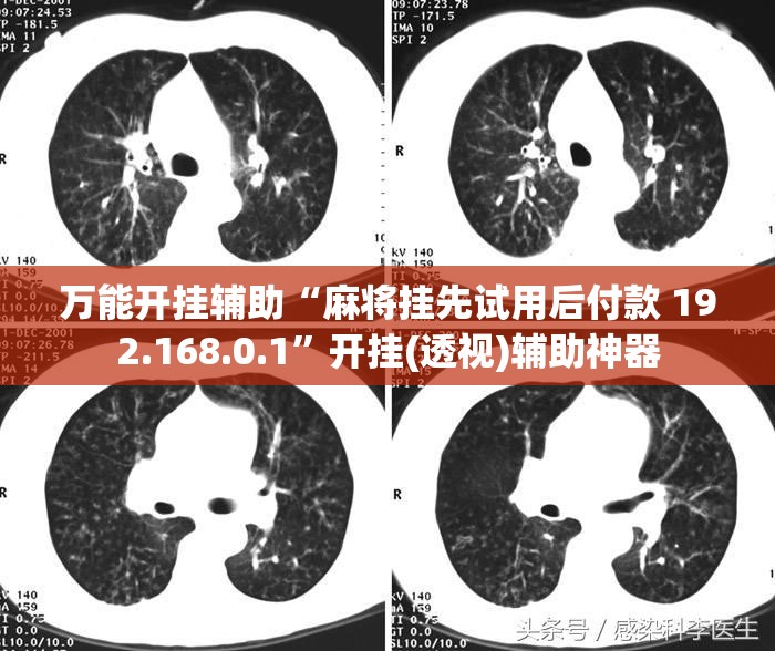 万能开挂辅助“麻将挂先试用后付款 192.168.0.1”开挂(透视)辅助神器