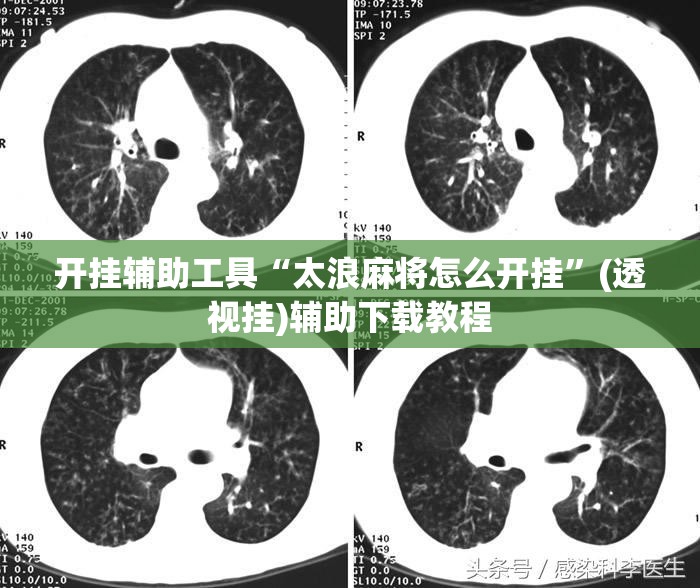 开挂辅助工具“太浪麻将怎么开挂	”(透视挂)辅助下载教程