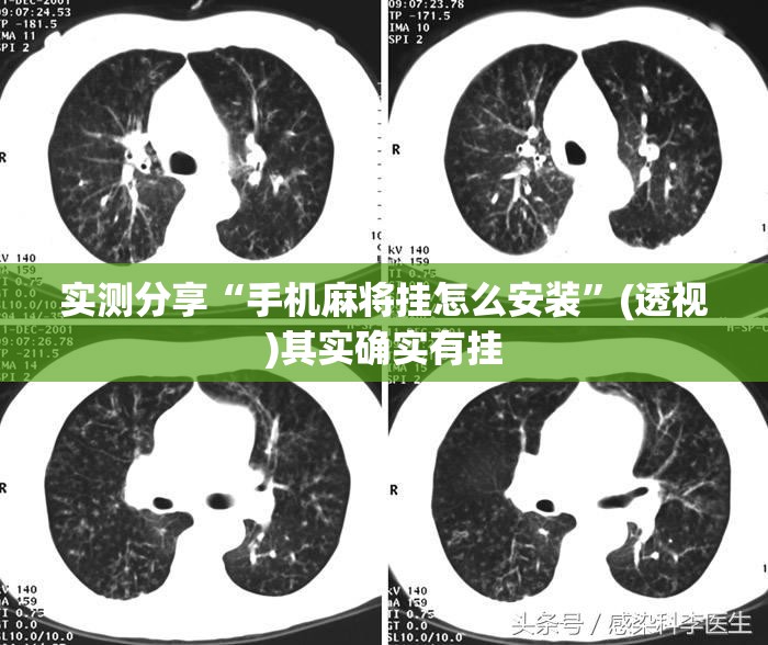 实测分享“手机麻将挂怎么安装”(透视)其实确实有挂