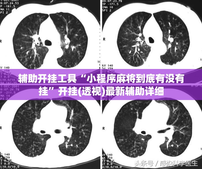 辅助开挂工具“小程序麻将到底有没有挂”开挂(透视)最新辅助详细
